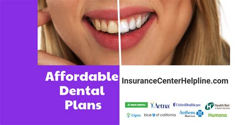 How does the dental insurance work? What is the best ...