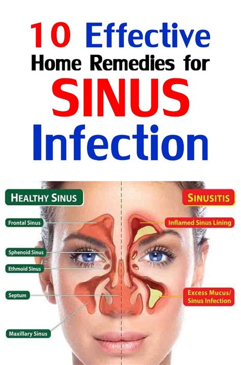 Sinus Infections Causes Symptoms And Treatment Futonadvisors
