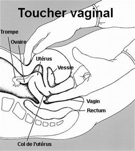Le toucher vaginal doit il être systématique Oummi Materne Le