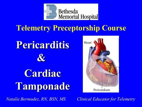 Pericarditis Pericardial Effusion And Cardiac Tamponade Bmhtele