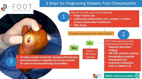 3 Steps For Diagnosing Diabetic Foot Osteomyelitis · 3 Steps For