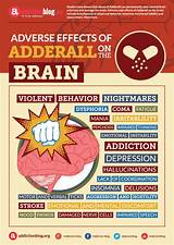 Pictures of Adderal  R Side Effects