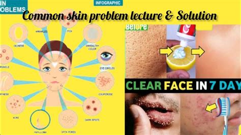 Common Skin Problems Skin Disease Common Nursing Care Common Skin