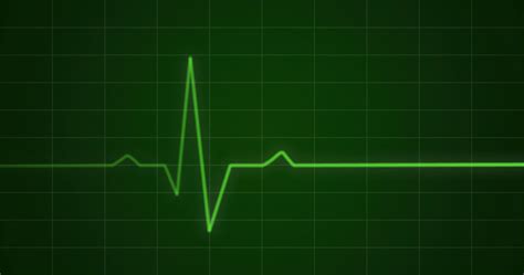 Ecg Electrocardiogram And Heart Beat Shape Hoodoo Wallpaper