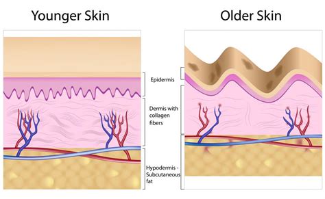 What Are The Benefits Of Collagen And Elastin With Pictures