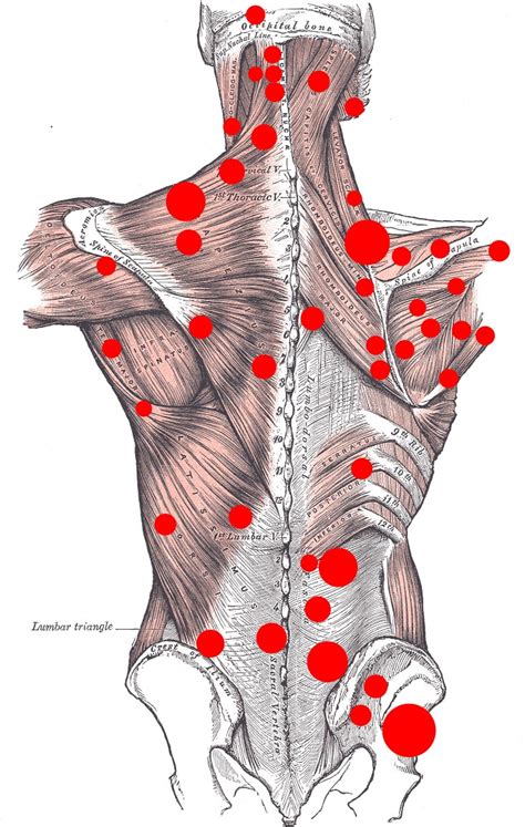 The body back company strives to provide simple, affordable massage tools for those who do not have access to professional massage therapists. Shoulder Trigger Points and IMS: An Effective Therapy you ...
