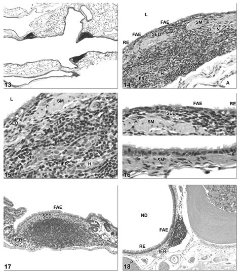 Normal Structure Function And Histology Of Mucosa Associated Lymphoid