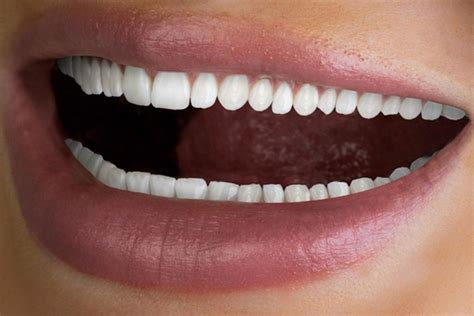 ‘creepy Tooth Whitening Advert Mocked After People Spot Model Has Sixty Teeth The Irish Sun