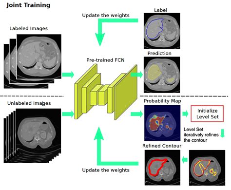 Deep Learning For Medical Image Segmentation Deepai Gambaran