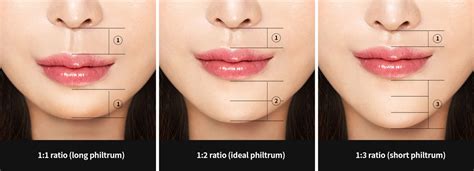 all about philtrum reduction surgery upper lip lift hyundai aesthetics blog