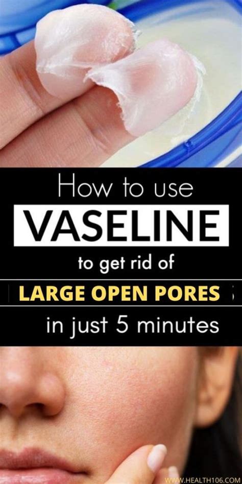 How To Use Vaseline To Get Rid Of Large Open Pores Health 106 In 2020