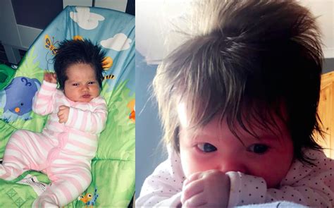 A Baby Was Born With An Incredible Head Of Hair After Being Visible On