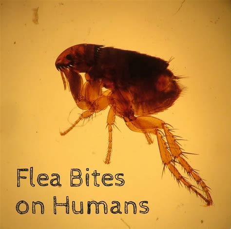 Briefly, infected bites will often appear red and swollen. Flea Bites on Humans: Symptoms and Treatment | Dengarden
