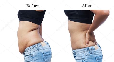 Maybe you would like to learn more about one of these? women body fat belly between before and after weight loss ...