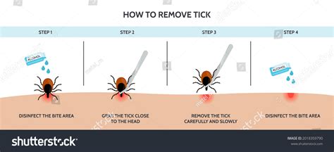 Correct Way Remove Tick Insect Correctly Stock Vector Royalty Free