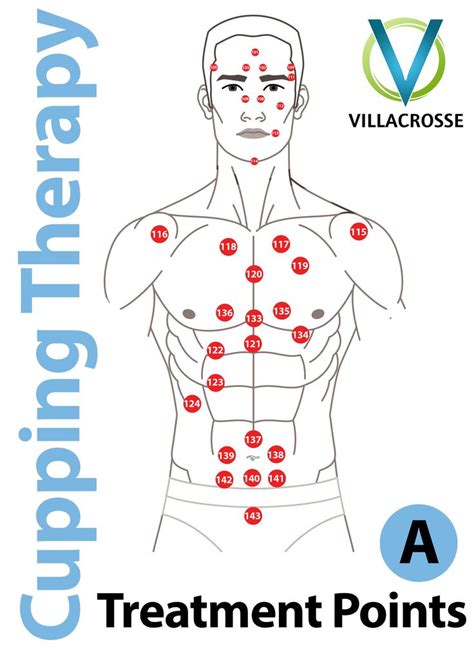 Cupping Points Cupping Therapy Cupping Points Hijama