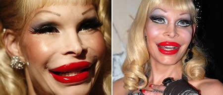 Viral Photos Worst Cosmetic Surgery Disasters Amanda Lepore World S