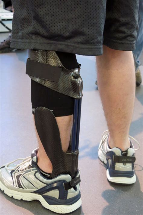 Orthotic Brace Takes Soldiers From Limping To Leaping Health News Florida
