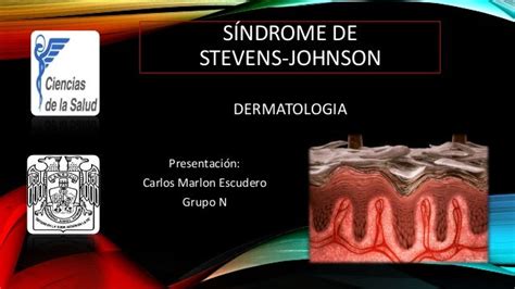 Síndrome De Stevens Johnson