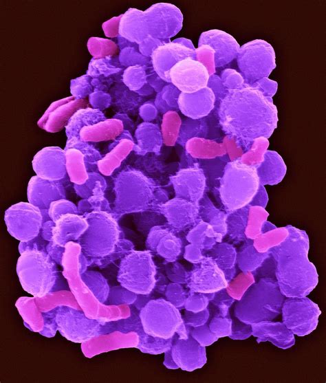 Human Tongue Oral Bacteria Photograph By Dennis Kunkel Microscopy