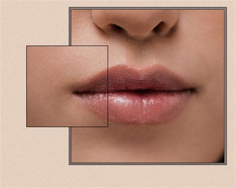 What Do Normal Lips Look Like