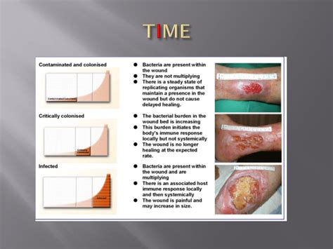 Ppt Wound Management Using ‘time Powerpoint Presentation Free
