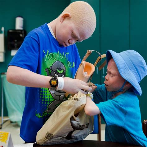 1st Of Tanzanian Albino Kids With Missing Limbs Goes Home The Seattle