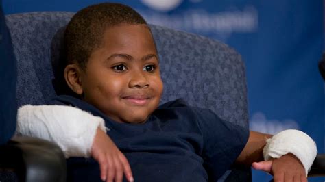 American Boy Is Worlds Youngest Person To Get Double Hand Transplant