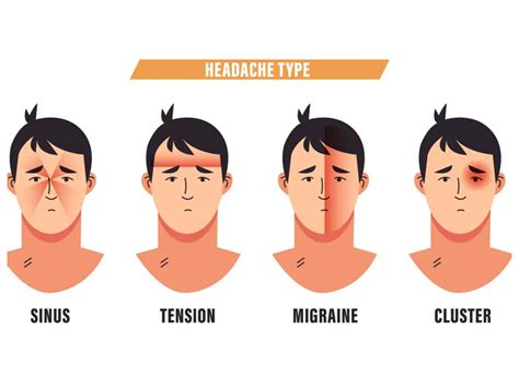 Headache Chart Types By Symptoms Location And Causes 50 Off