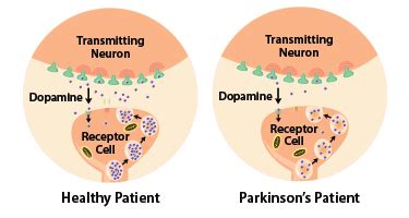 We did not find results for: What the Parkinson's Cure May Stem From — Rice Catalyst