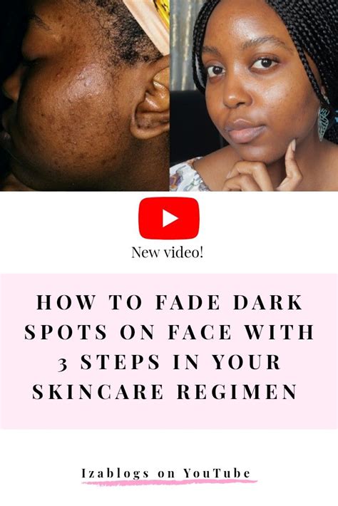 How To Get Rid Of Dark Spots On Face From Acne Dark Spots On Face