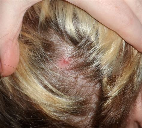 Hi Ive Got A Problem With My Scalp And I Have No Idea What