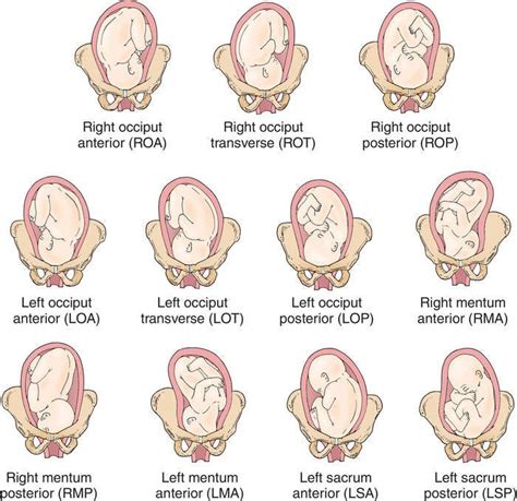 Lot Baby Position