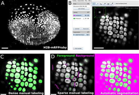 Frontiers Labkit Labeling And Segmentation Toolkit For Big Image Data