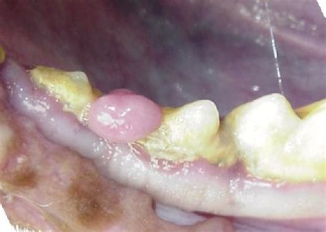 Oral Masses Benign Fibromatous Epulis In Dogs Canis Vetlexicon