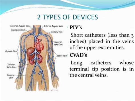 Femoral Venous Catheter