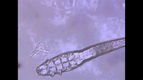 Demodex Canis Youtube