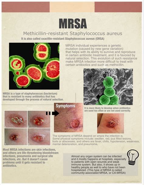 More Mrsa Info For Your Health Country Foot Care