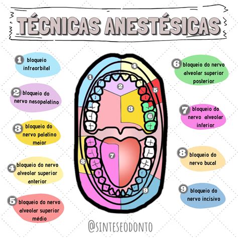 Tecnicas Anestesicas Na Odontologia