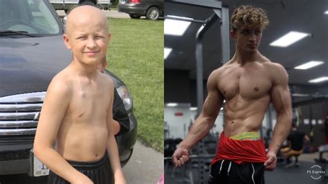Child Amputee W One Leg To 17 Year Old Bodybuilder Transformation