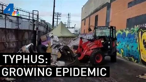 Typhus Epidemic Worsens In Los Angeles Nbcla Youtube