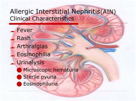 Ppt Acute Renal Failure Powerpoint Presentation Free Download Id