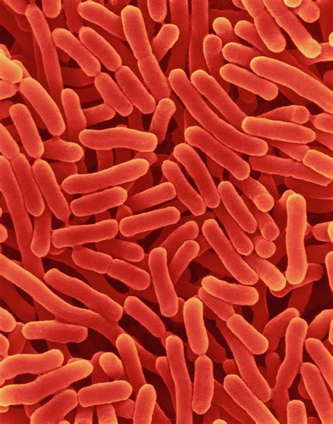 Salmonella Enterica 2 Photograph By Dennis Kunkel Microscopyscience