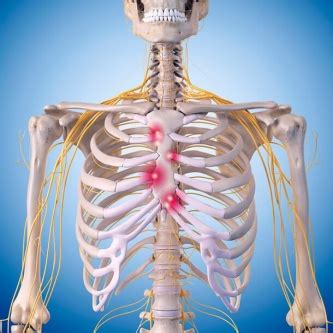 The space between the second and third ribs is called the adheres to the heart and forms the epicardium. Costochondritis - Physiopedia