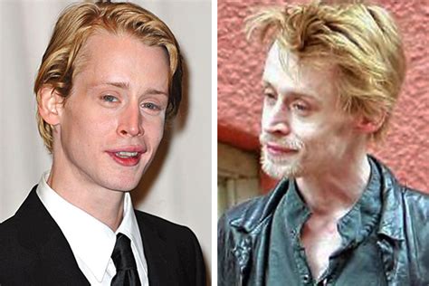 You Wont Believe These Photos Of Celebrities Before And After Drugs POP Hitz Celebrity