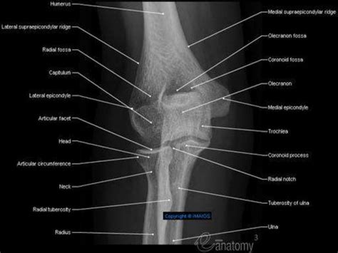 Supracondylar Fracture Of The Humerus By Phaneendra Akana Ppt