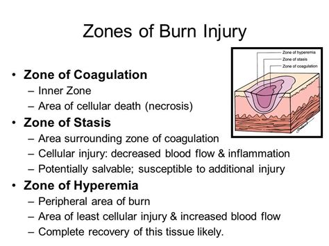 Medical Terminology Study Burn Injury Anatomy And Physiology