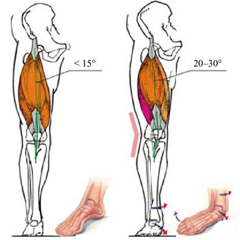 It will generate a textual output indicating which elements are in each intersection. Leg Muscles Diagram / Muscles Of The Lower Leg And Foot ...