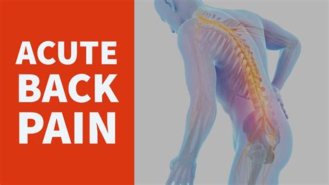 Video Acute Back Pain Chironexus News