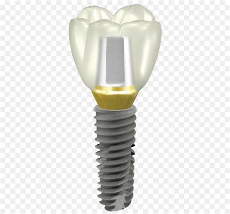 Implante Dentário Implante Pilar png transparente grátis